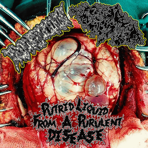 Pigto : Putrid Liquid from a Purulent Disease